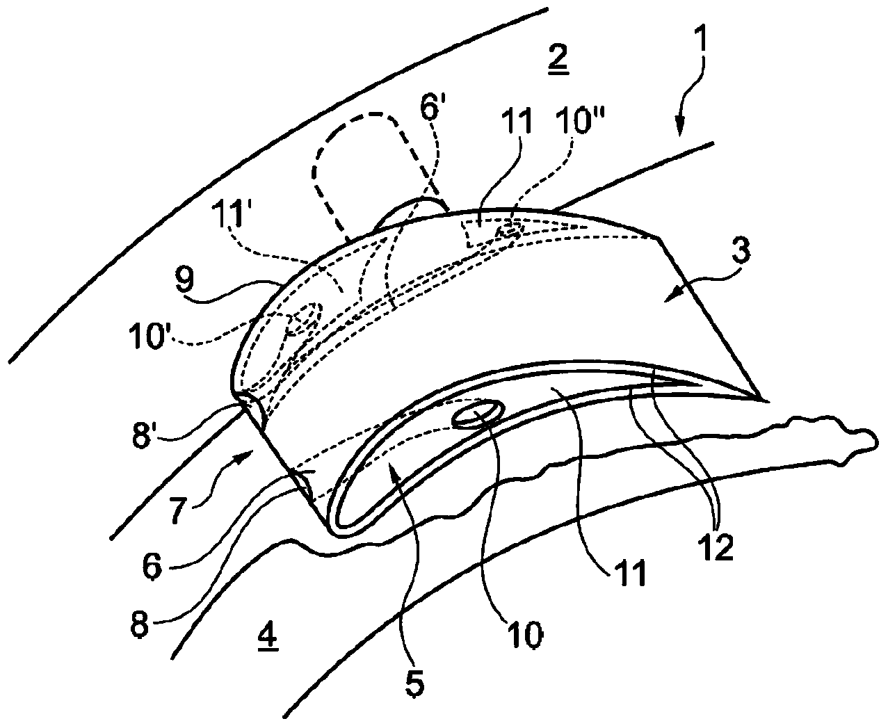 Variable turbine/compressor geometry