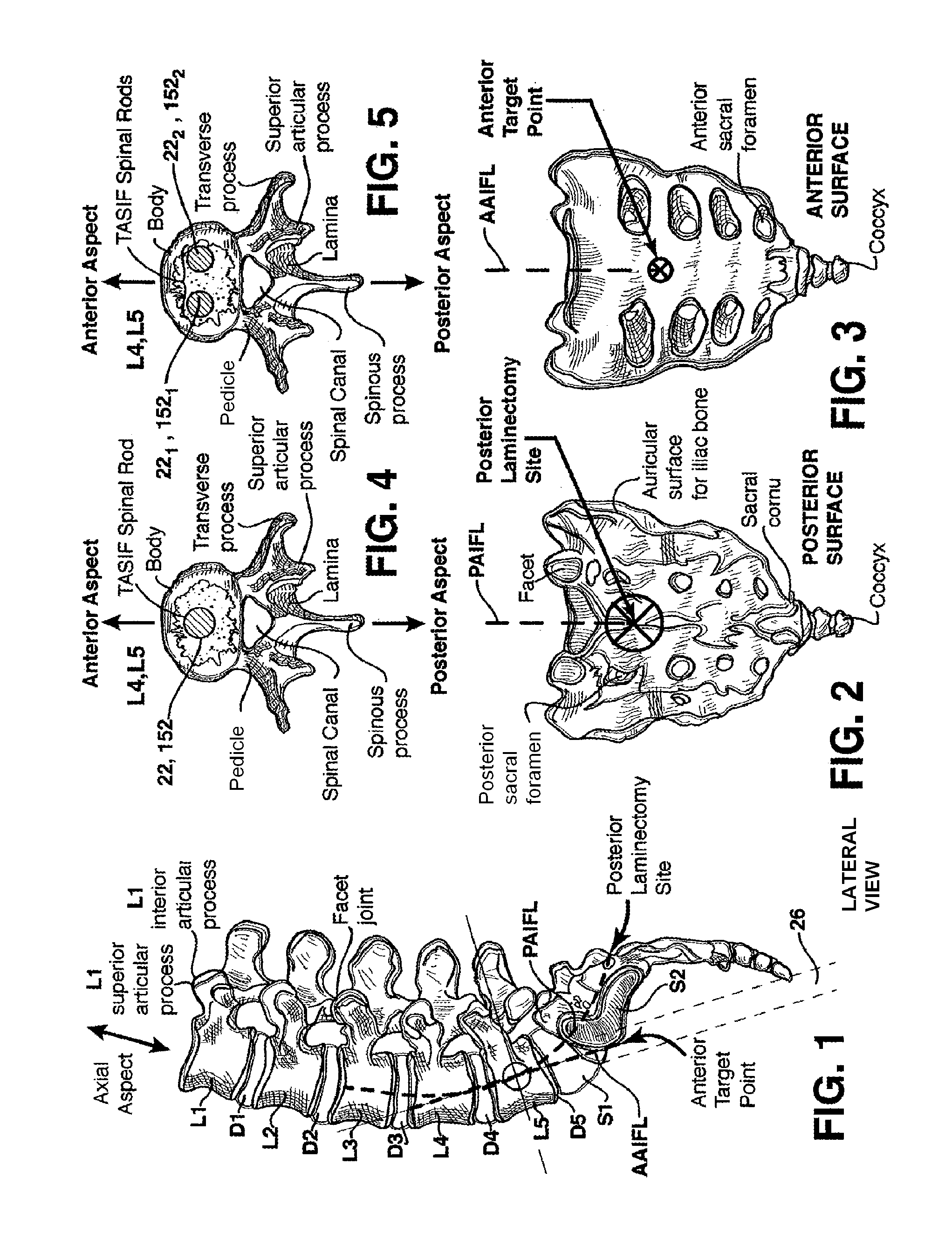 Method and apparatus for providing access to a presacral space