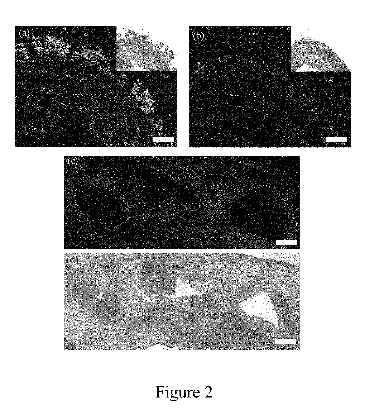 Bioscaffold, method for producing the same, and uses thereof