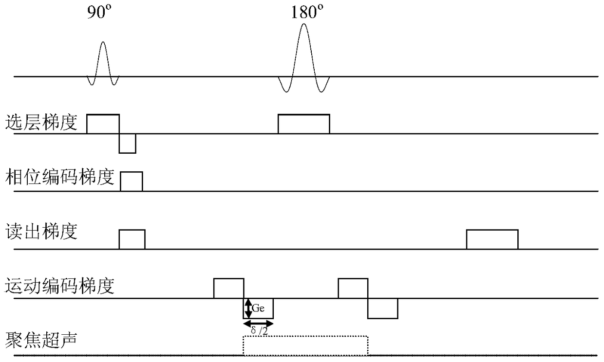 Tissue displacement measurement method and system based on magnetic resonance acoustic radiation force imaging