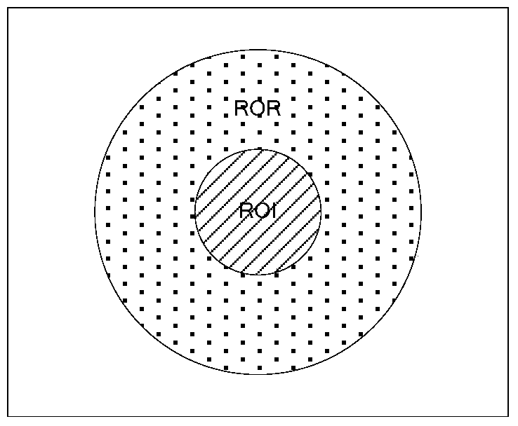 Tissue displacement measurement method and system based on magnetic resonance acoustic radiation force imaging