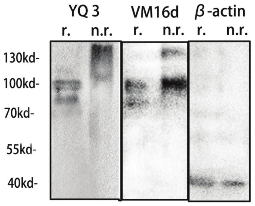 Monoclonal antibody targeting platelet membrane glycoprotein gpibα for inhibiting tumor metastasis and screening method thereof