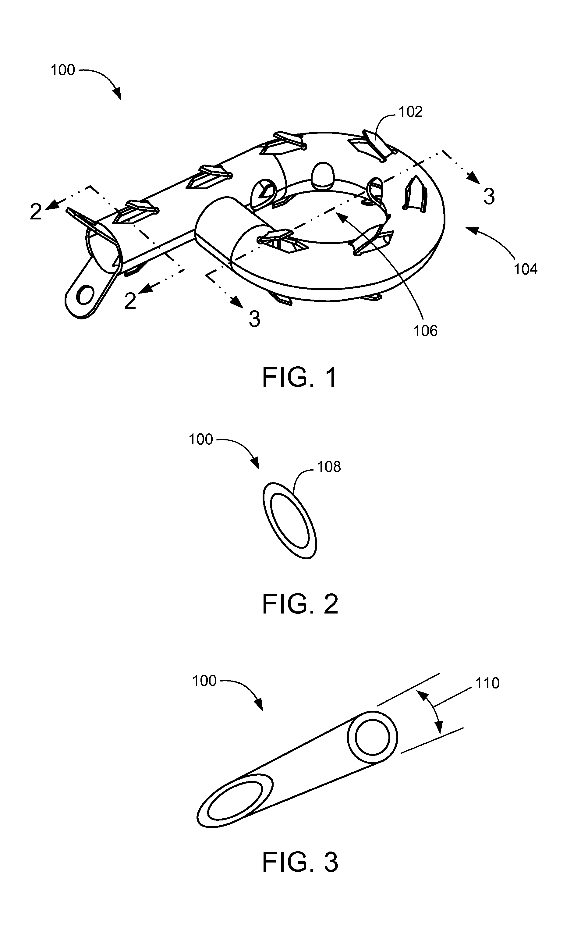 Memory material implant system and methods of use