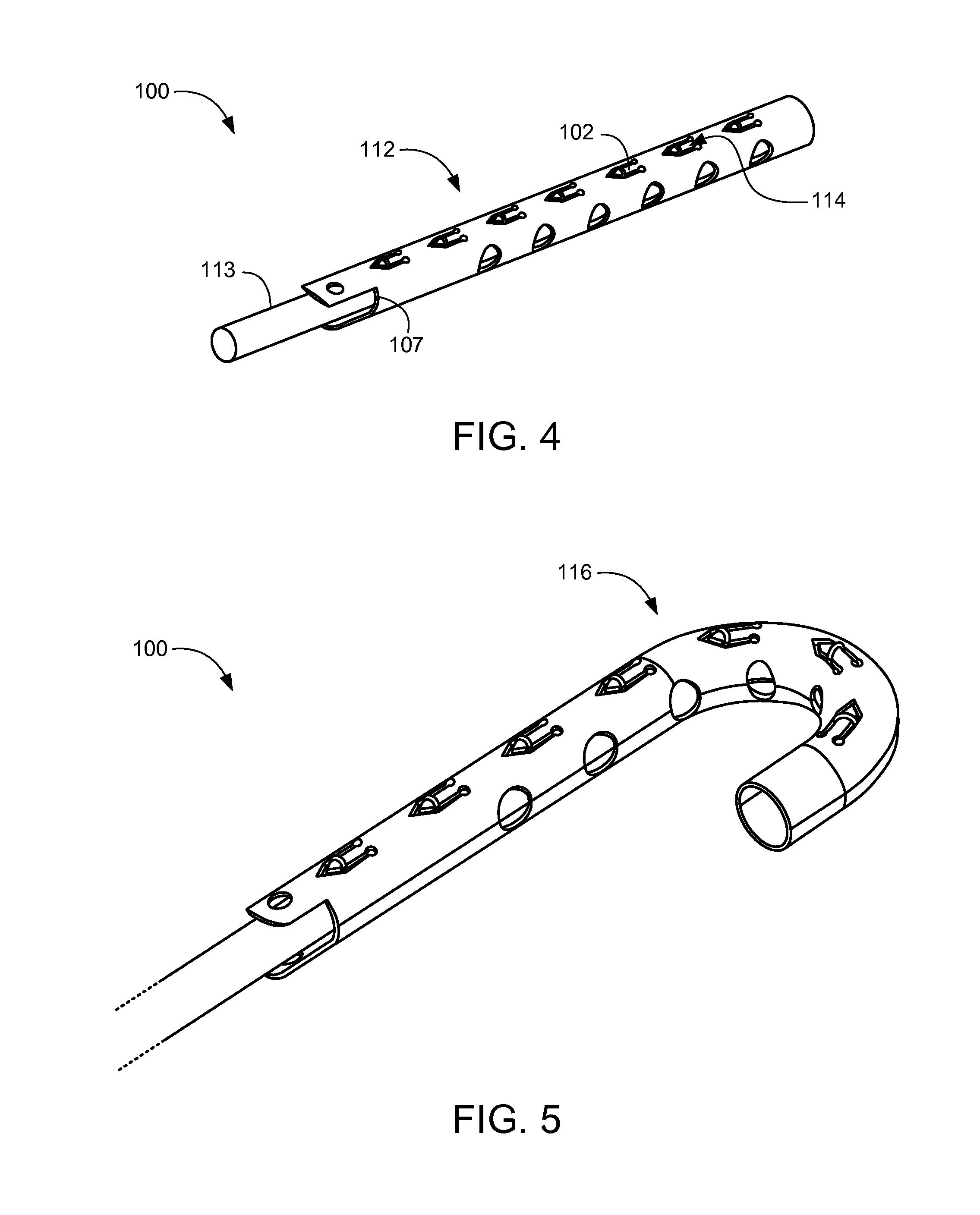 Memory material implant system and methods of use