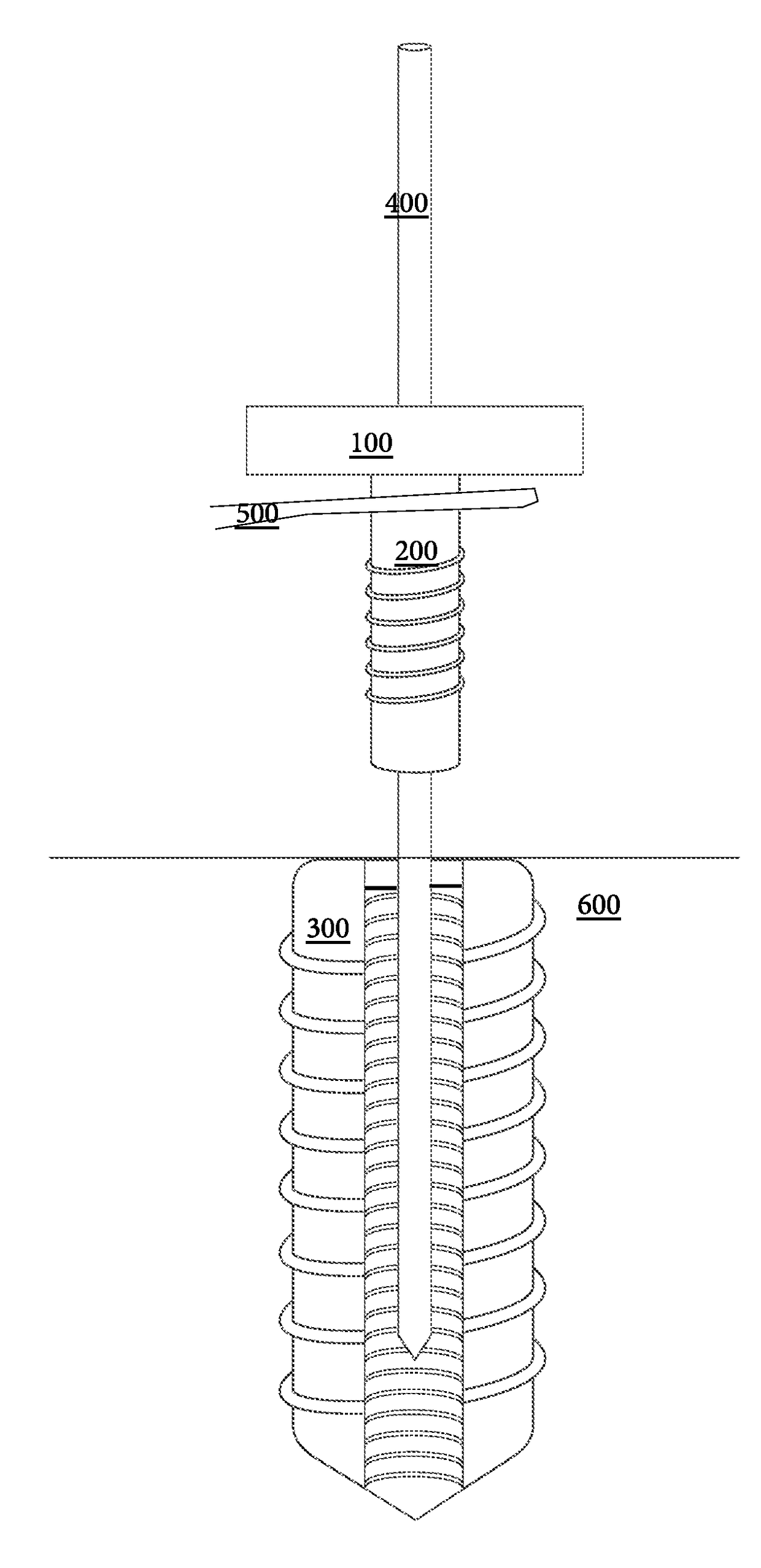 Interconnecting Cannulated Soft Tissue Screw System and Related Methods