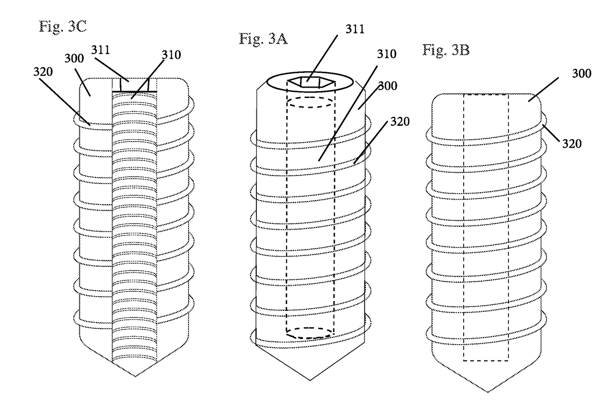 Interconnecting Cannulated Soft Tissue Screw System and Related Methods