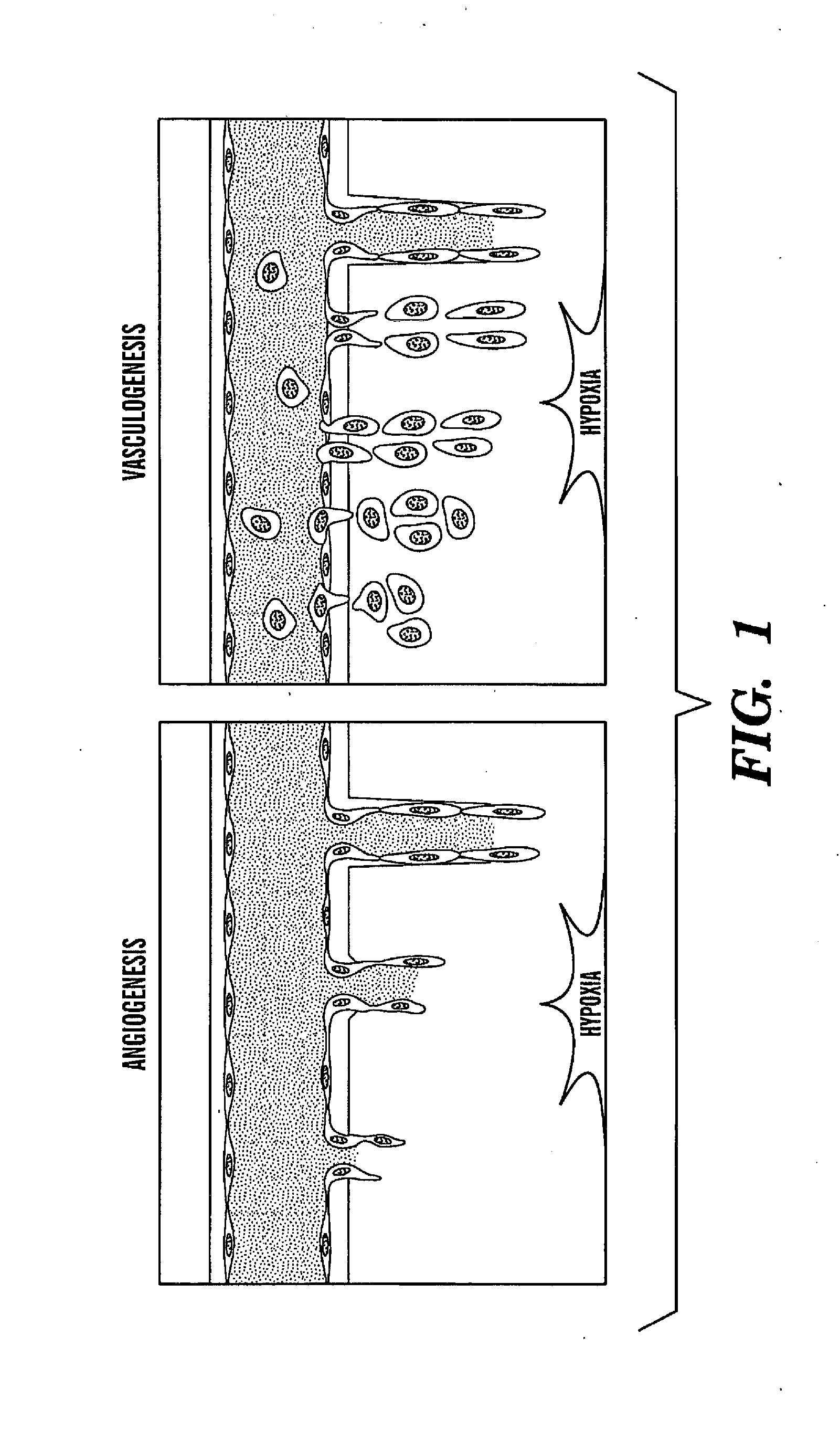 Method Of Treating Or Preventing Pathologic Effects Of Acute Increases In Hyperglycemia And/Or Acute Increases Of Free Fatty Acid Flux