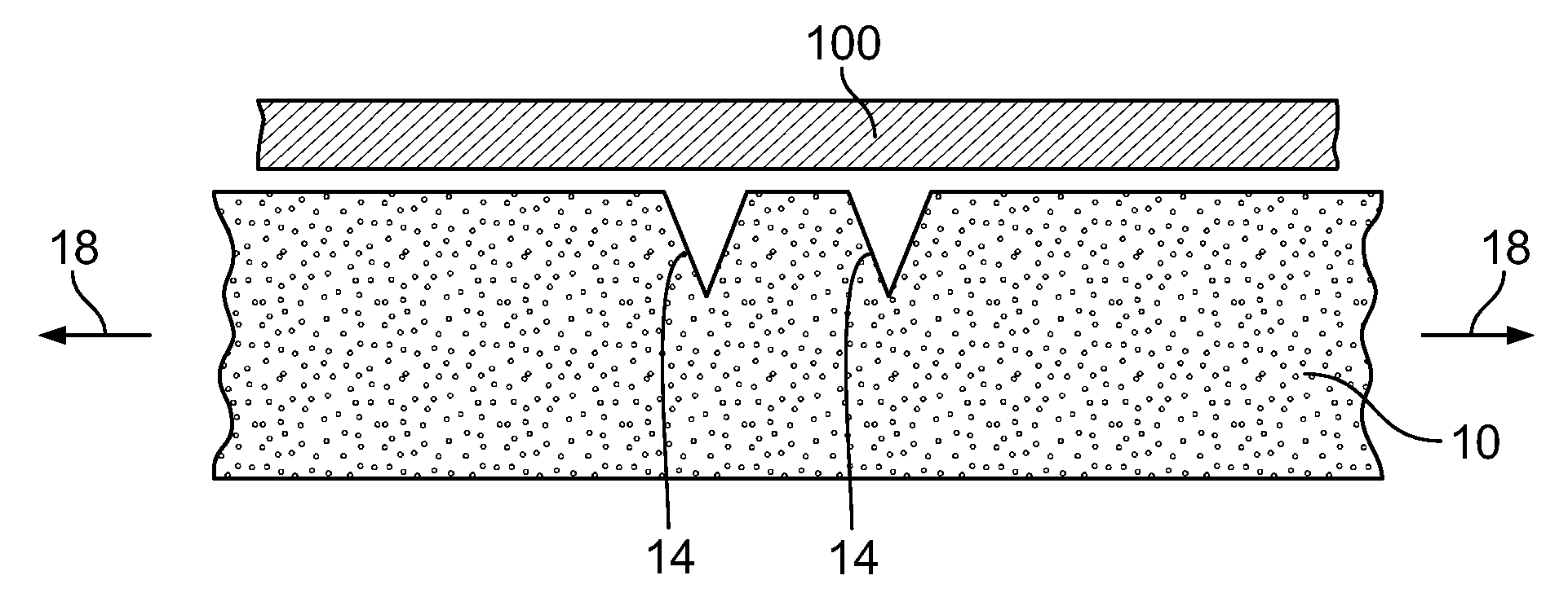 Devices and methods for skin tightening