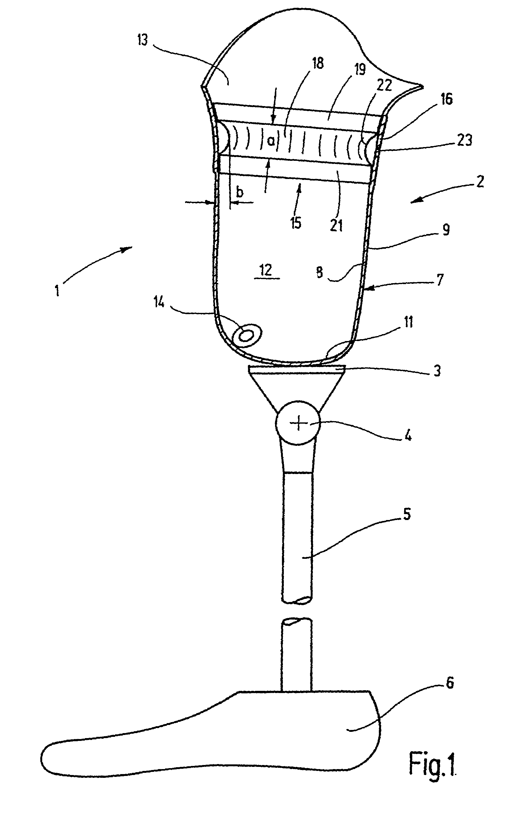 Sealing sleeve for sealing residual limb in a prosthetic socket