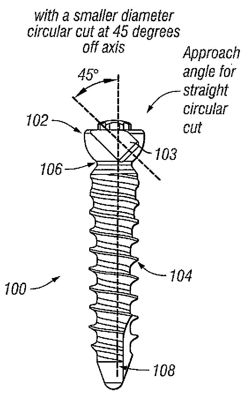 Spinal Stabilization Systems and Methods