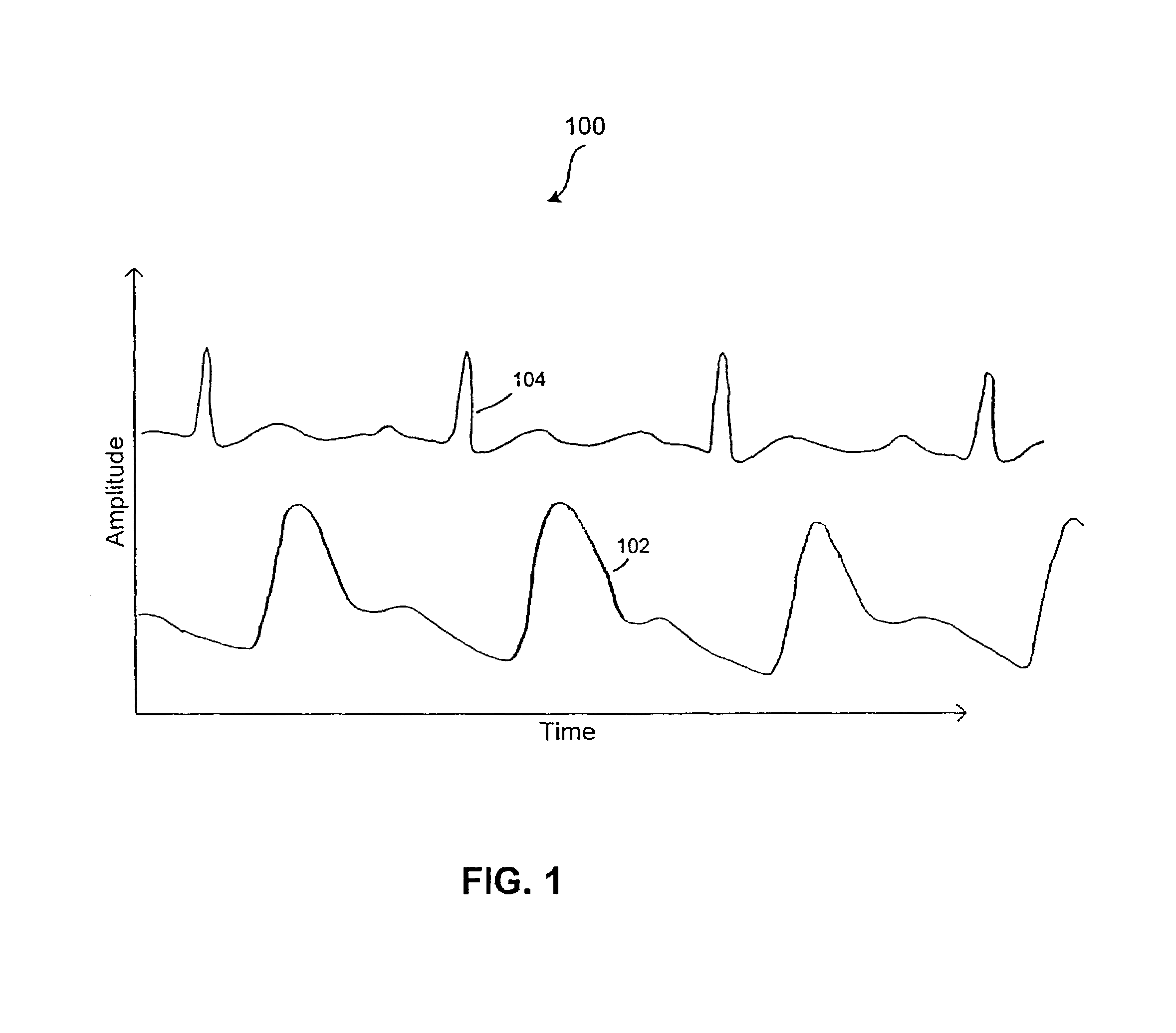Methods and devices for reduction of motion-induced noise in optical vascular plethysmography