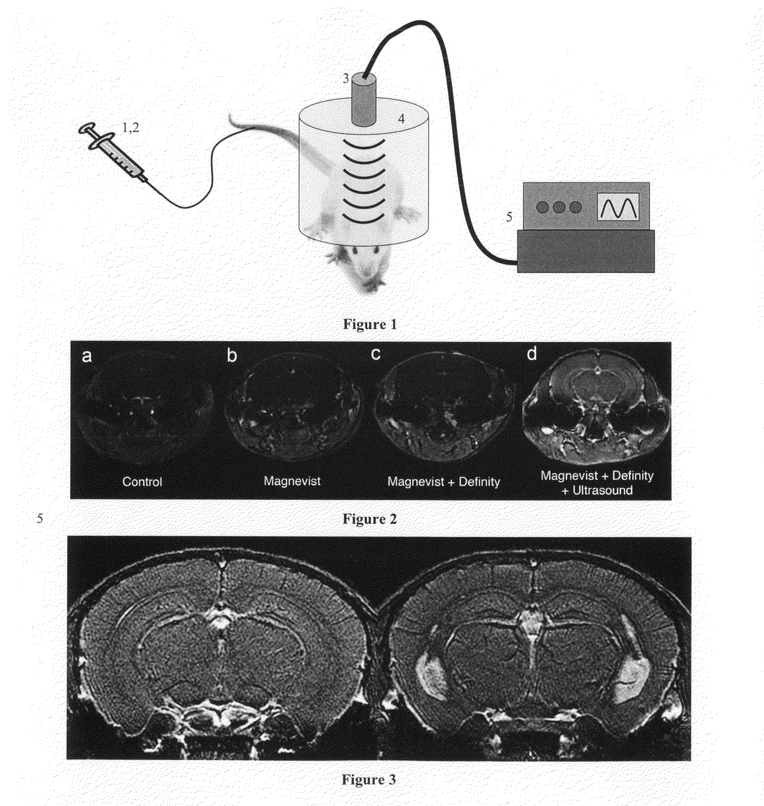 Method and apparatus for delivery of agents across the blood brain barrier