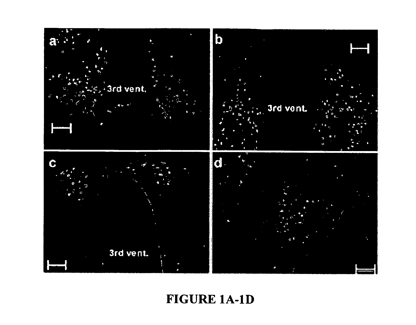 Methods and assays for treating or preventing obesity and/or diabetes or increasing insulin sensitivity