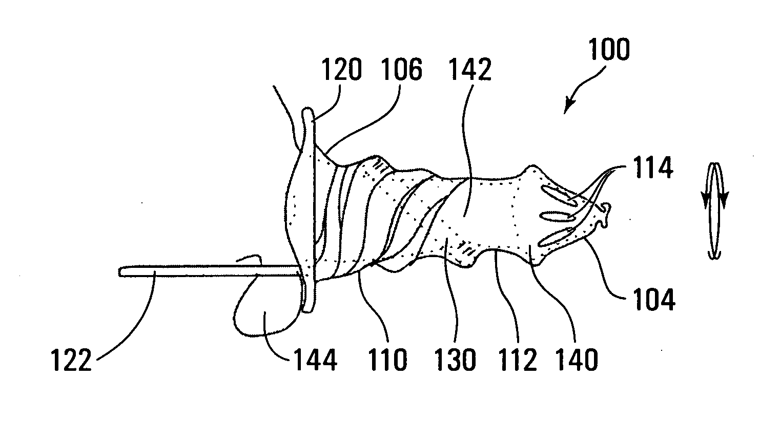 External penile prosthesis, combination of prosthesis and loose-fitting condom, and method of using condom