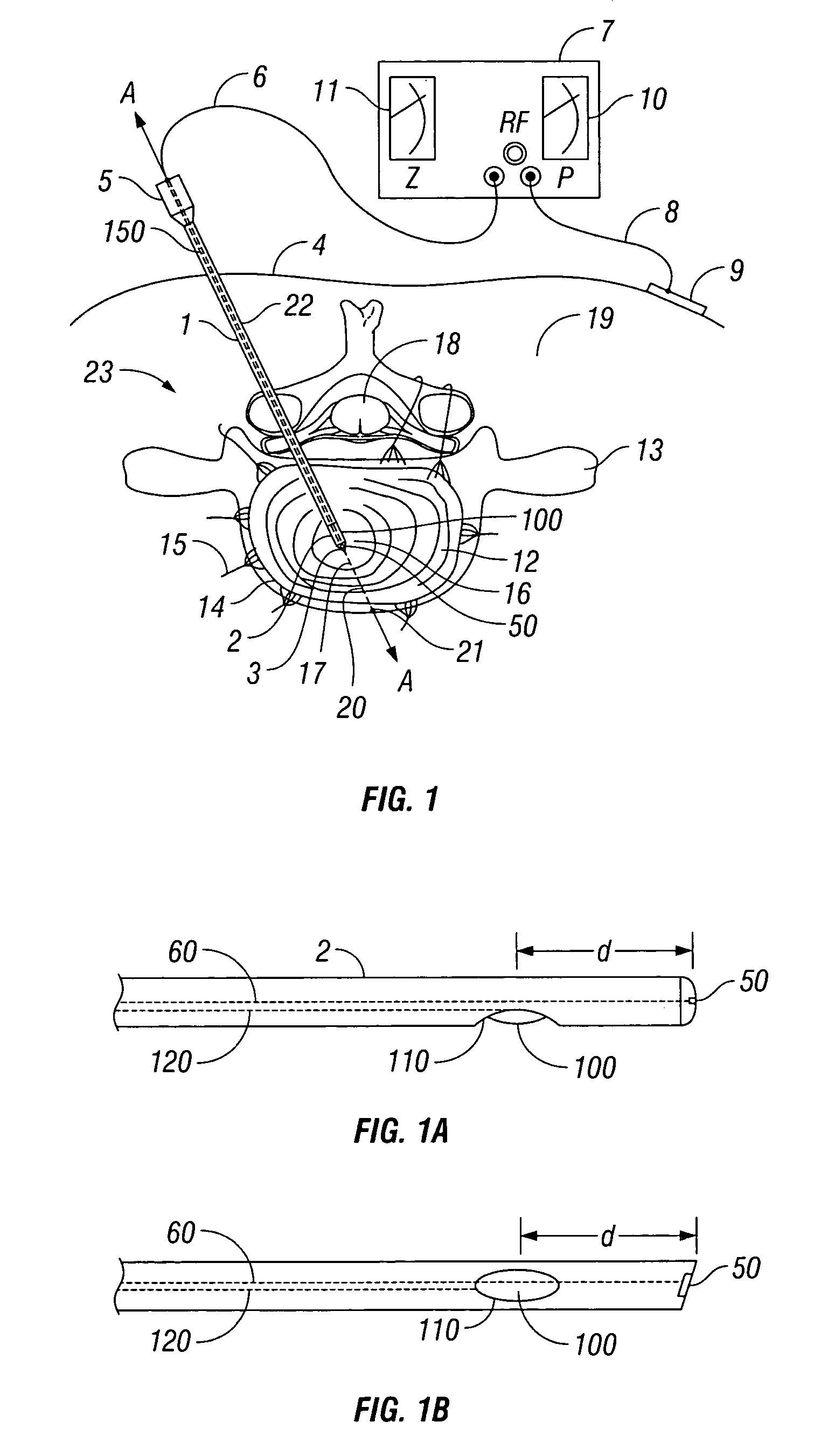 Method and apparatus for monitoring disc pressure during heat treatment of an intervertebral disc