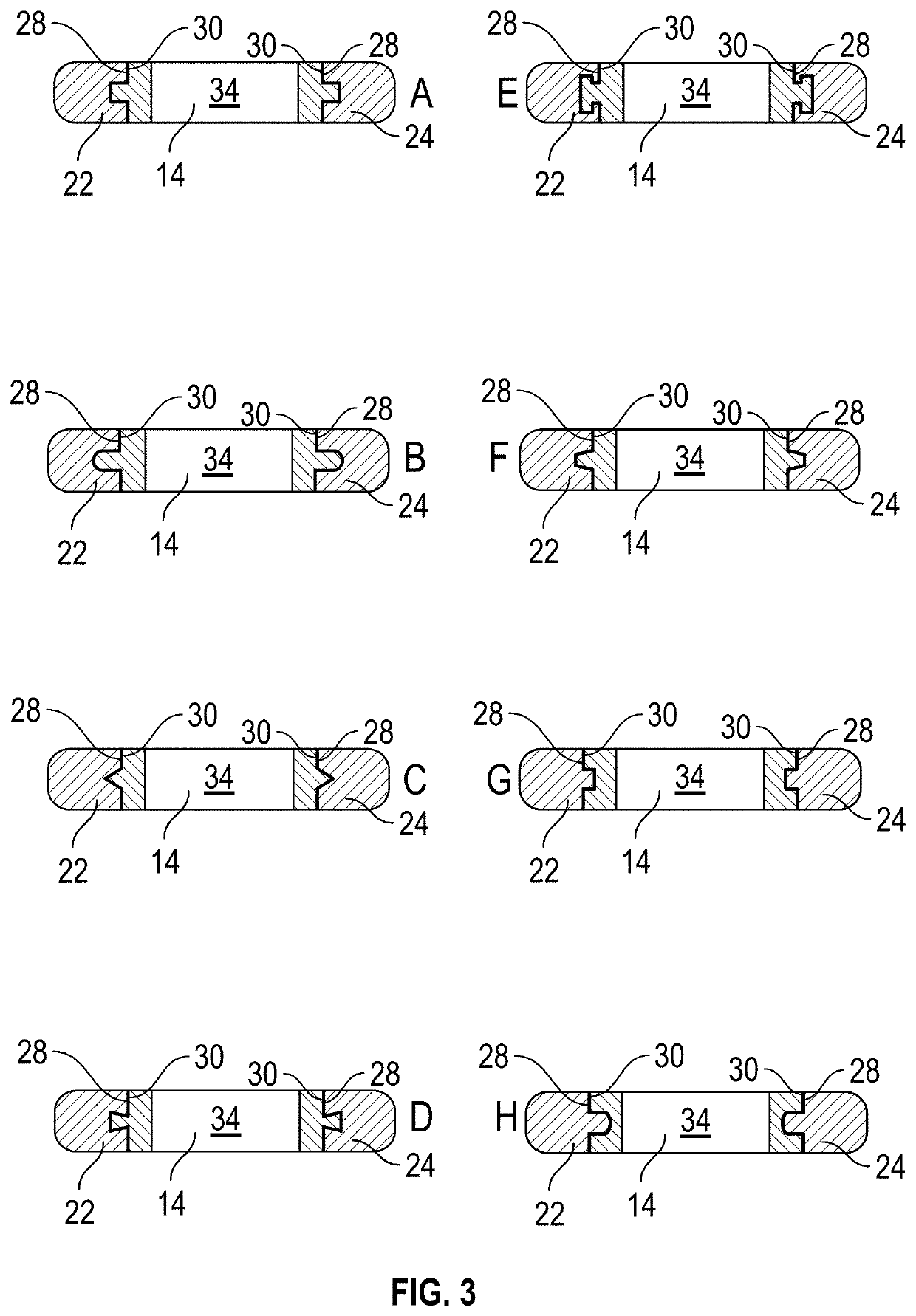 Press-Fit Anterior Cervical Plate