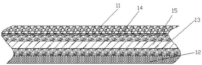 Warm keeping device for improving peripheral circulation of critically ill patient and working method