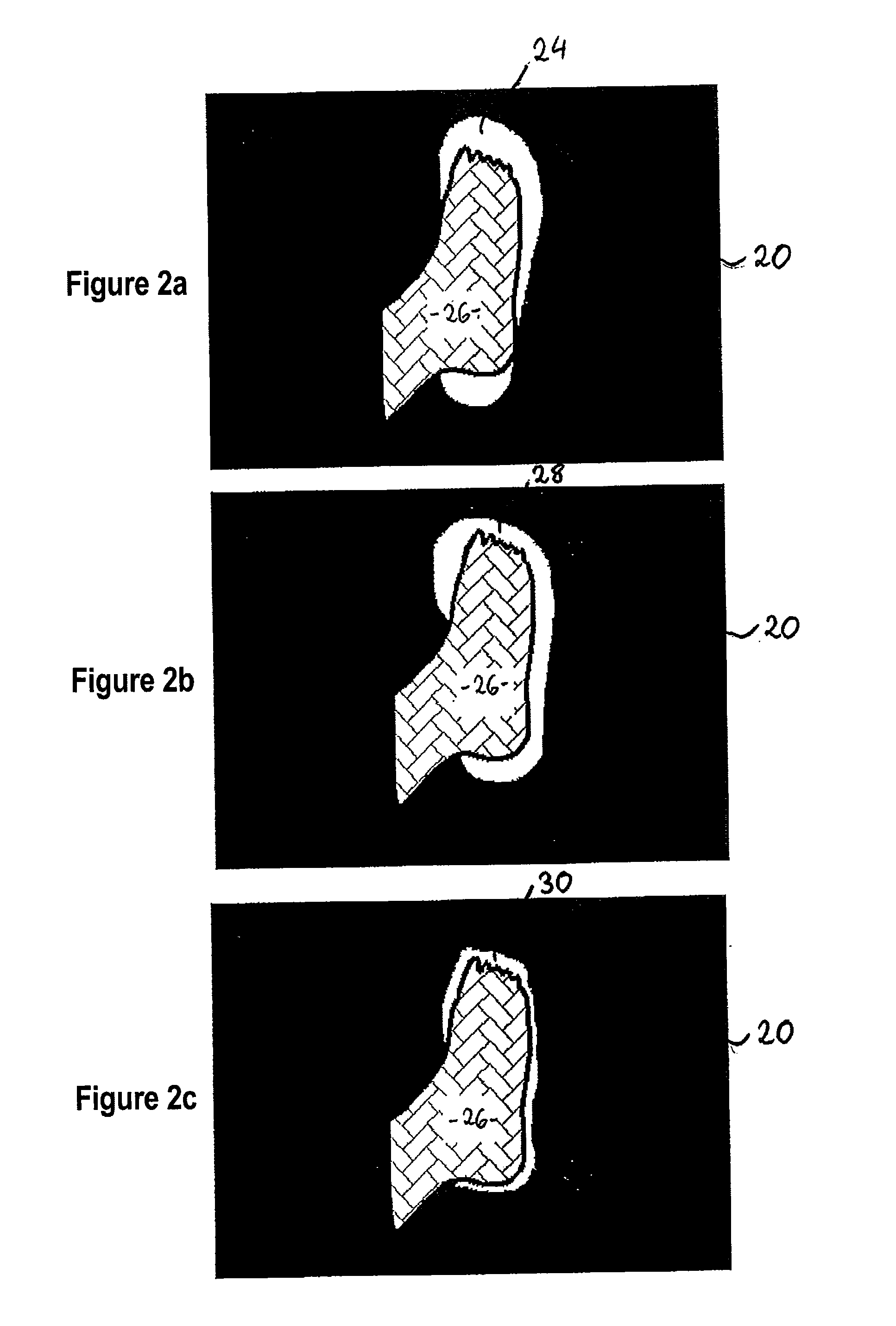 Method for selecting a shoe fitted to a foot and assemblies therefor