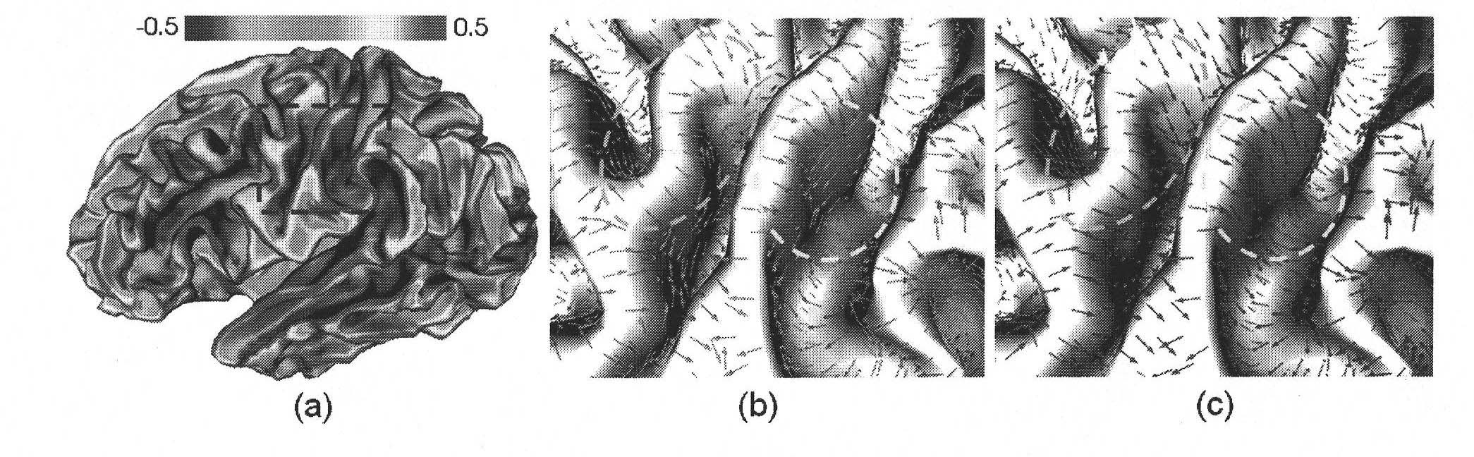 Three-dimensional brain magnetic resonance image brain cortex surface maximum principal direction field diffusion method