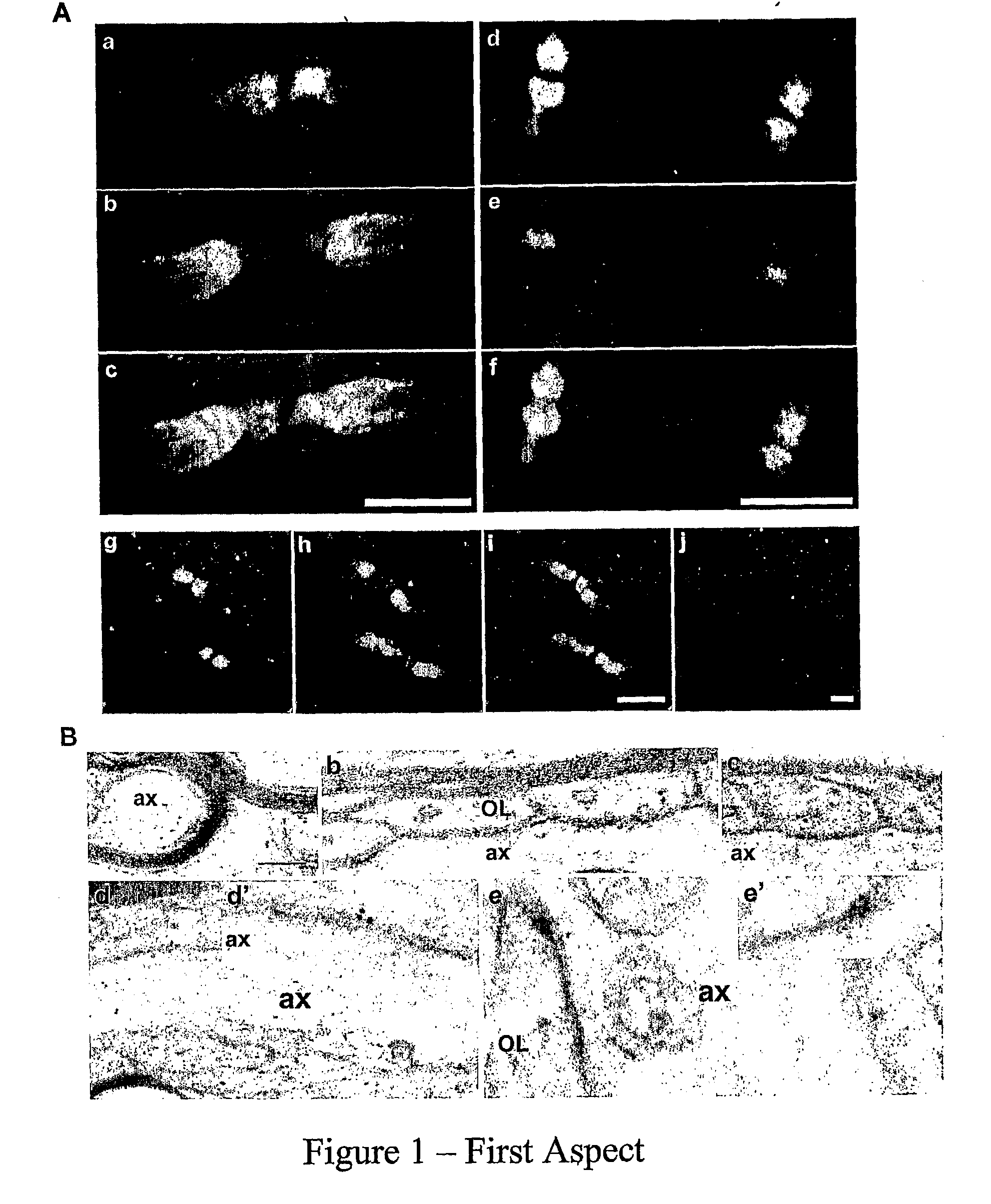Materials and methods relating to treatment of injury and disease to the central nervous system