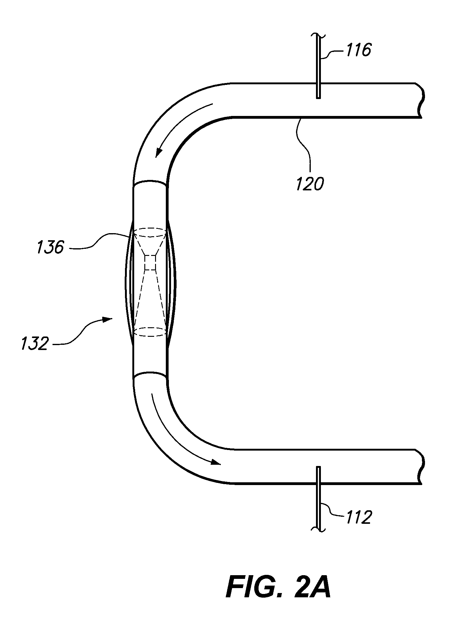 Adjustable stenosis and method therefor