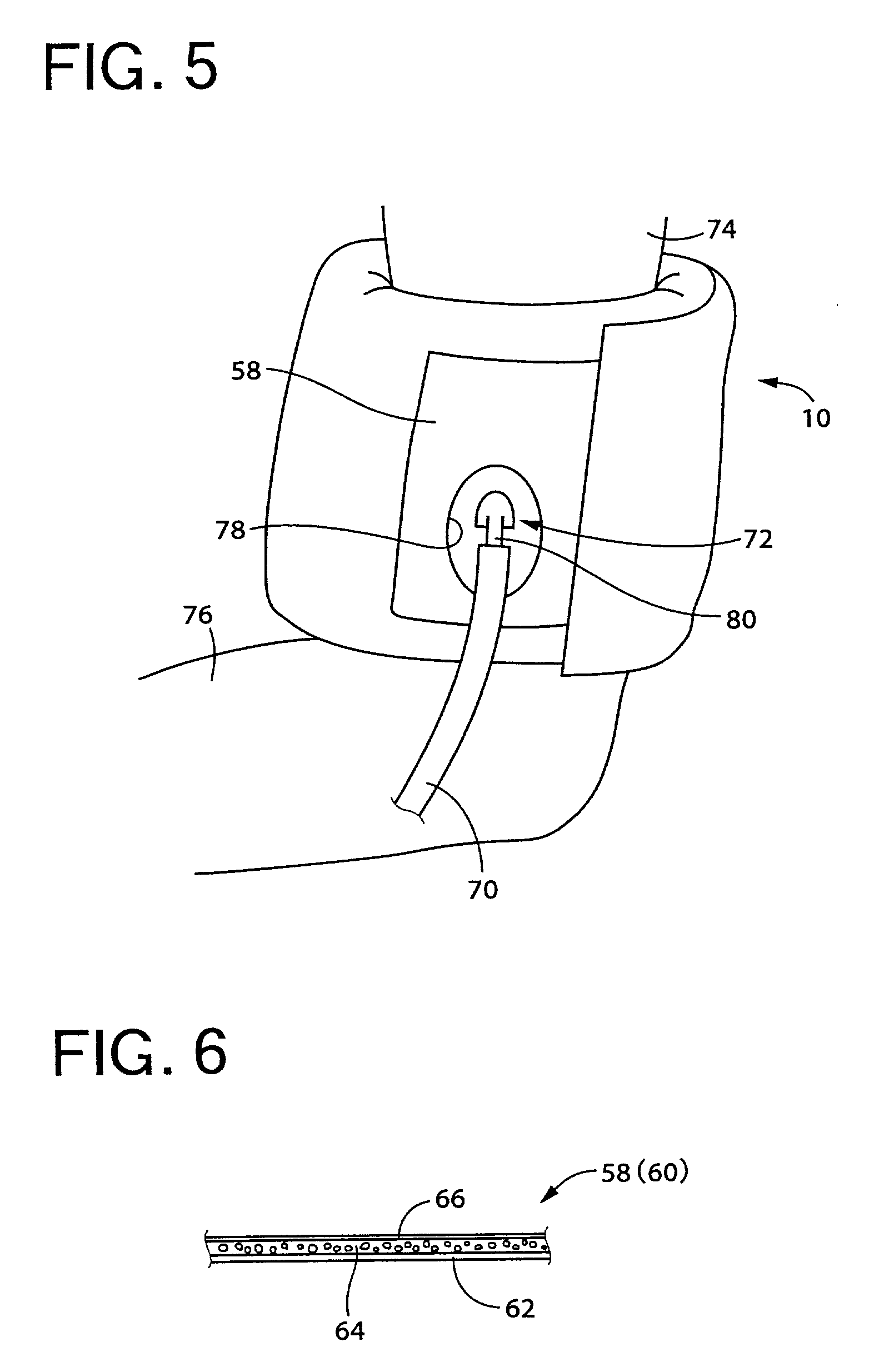 Inflatable cuff used for blood pressure measurement