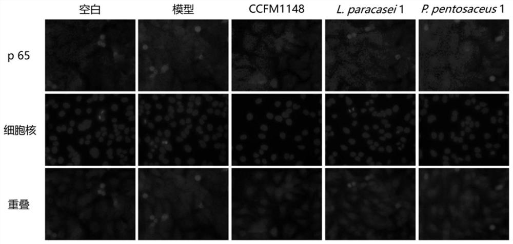 A bifidobacterium animal strain that can relieve psoriasis and its application