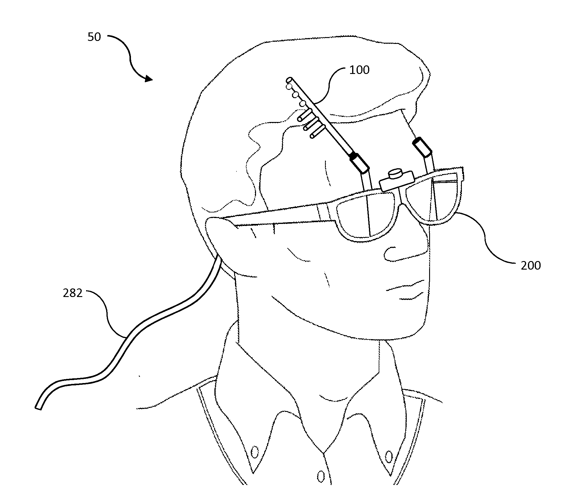 Methods and head-mounted devices for pain relief by stimulating treatment lines along the scalp