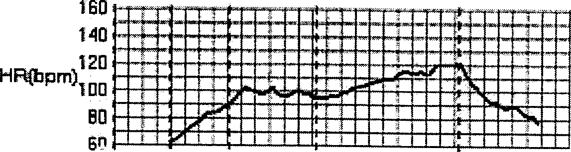 Alternating T-wave measuring method for sports electrocardiogram