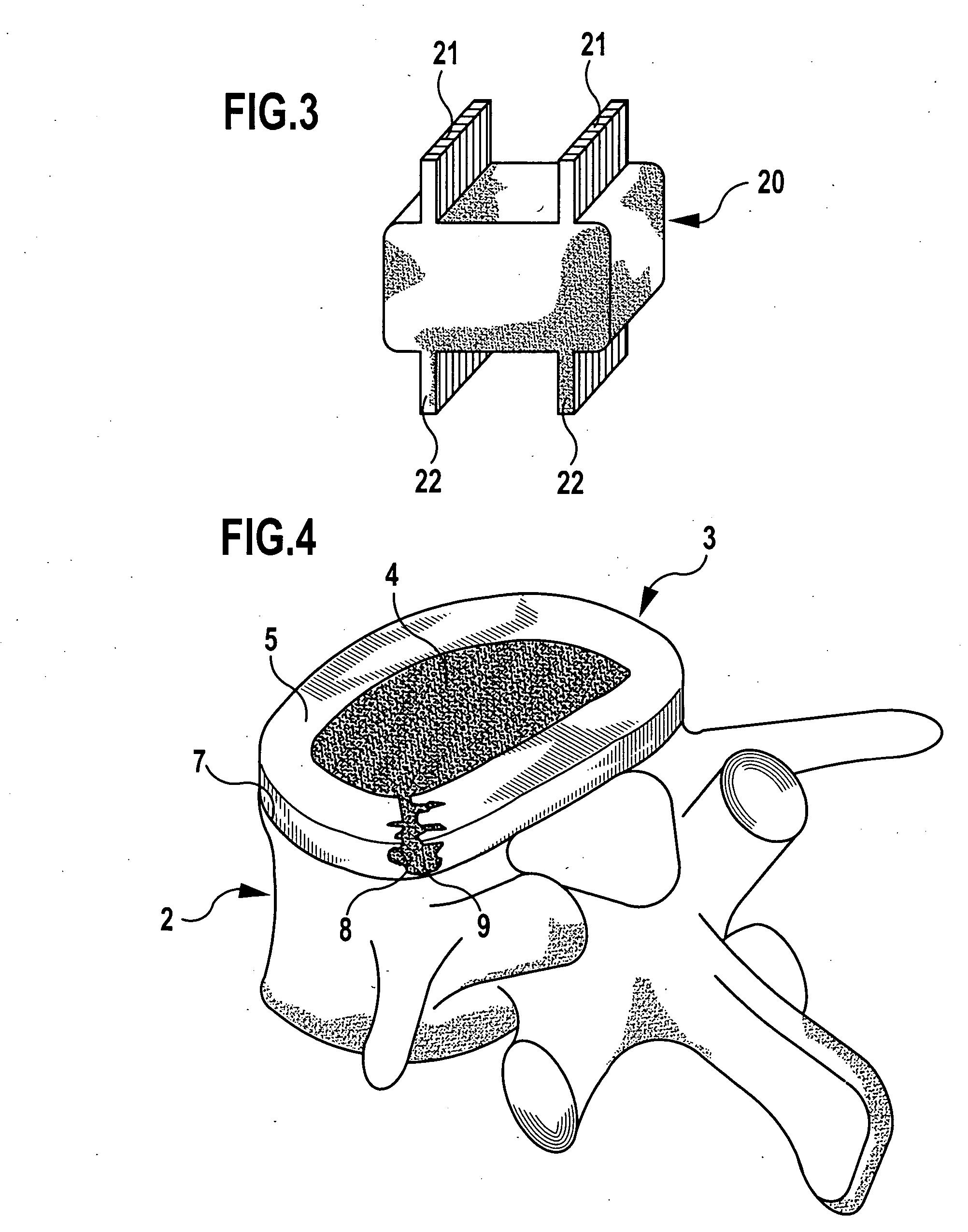 Implant for closing an opening in the annulus fibrosus