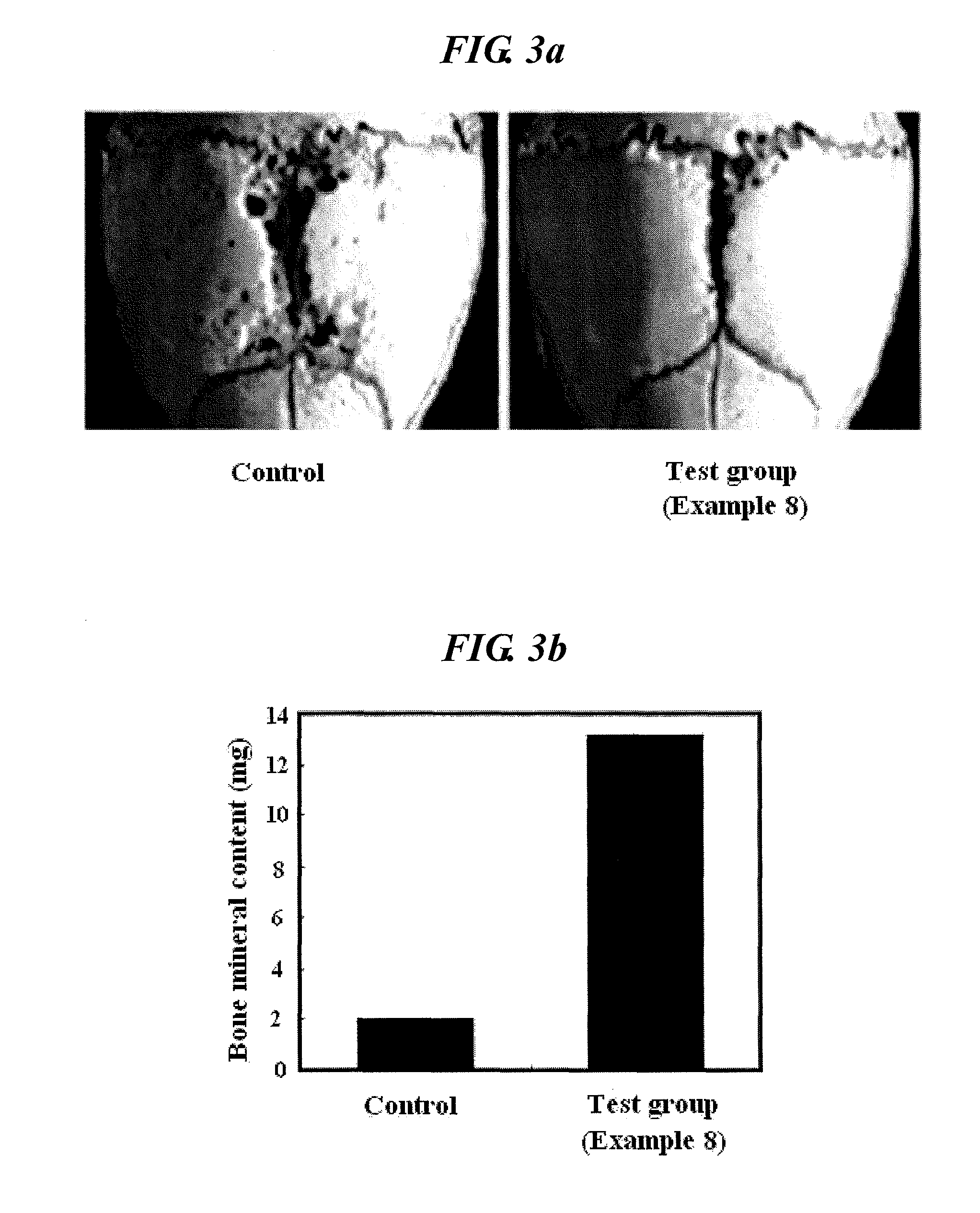 Isoindolinone derivatives, preparation method thereof and a pharmaceutical composition comprising same