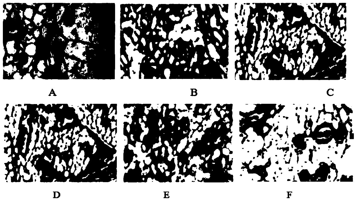 Topical Chinese medicine preparation for treatment of mammary breast gland lobular hyperplasia