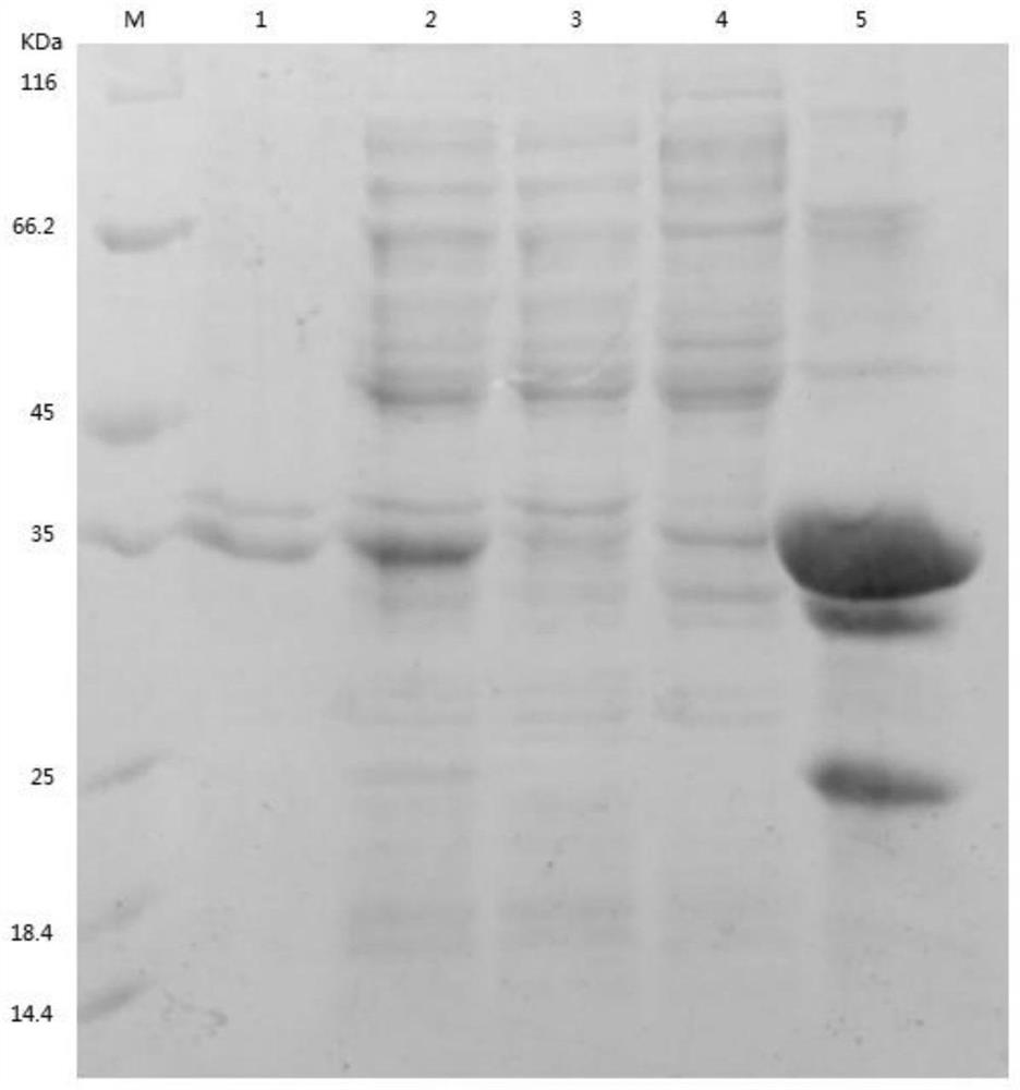 The Mature Peptide of Motistin, an Inhibitor of Leukotriene A4 Hydrolase in Myotis brucei and Its Application
