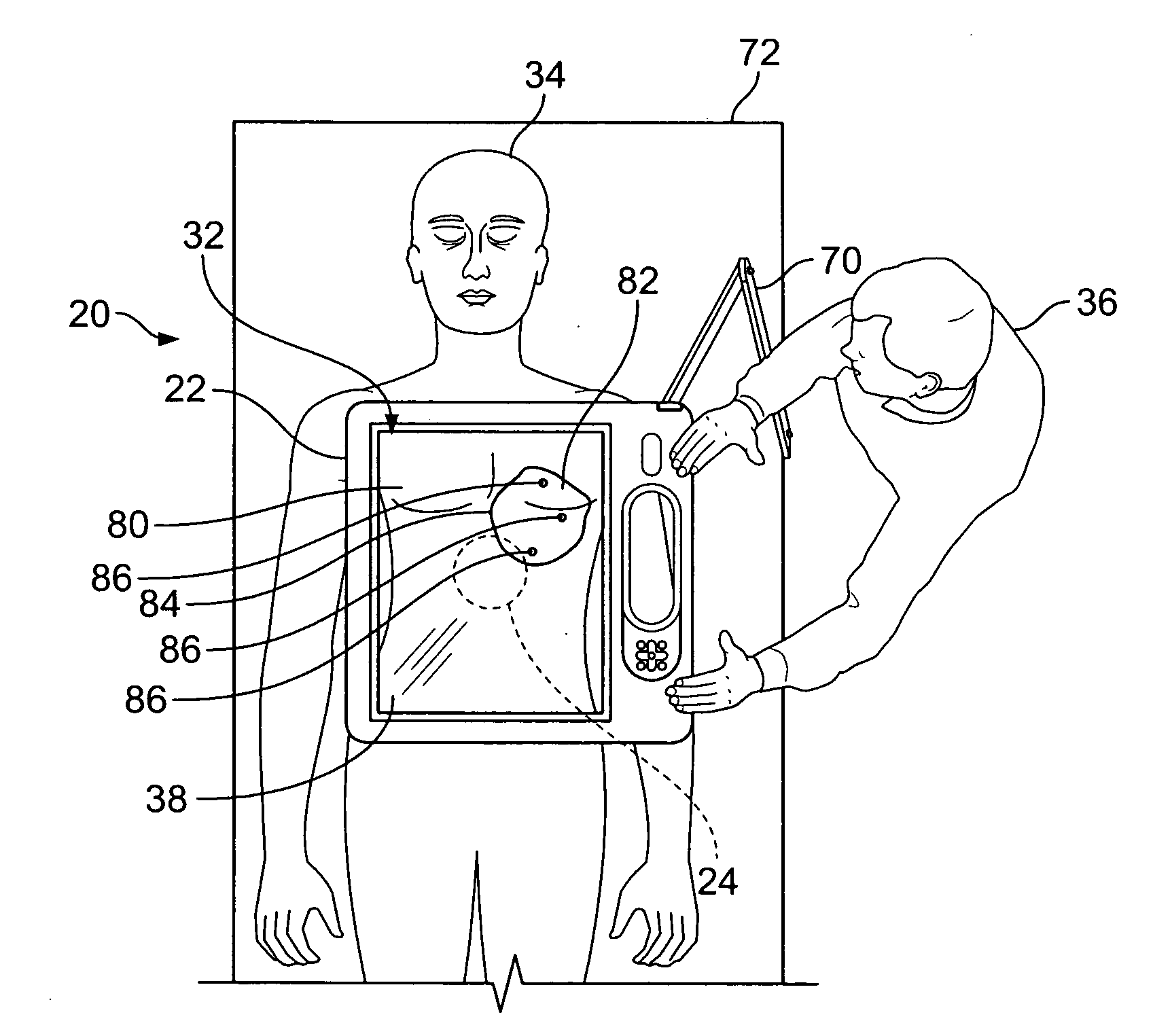 System for and method of visualizing an interior of body