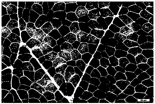 Myosin adenosine triphosphate staining method for frozen sections of skeletal muscle tissue