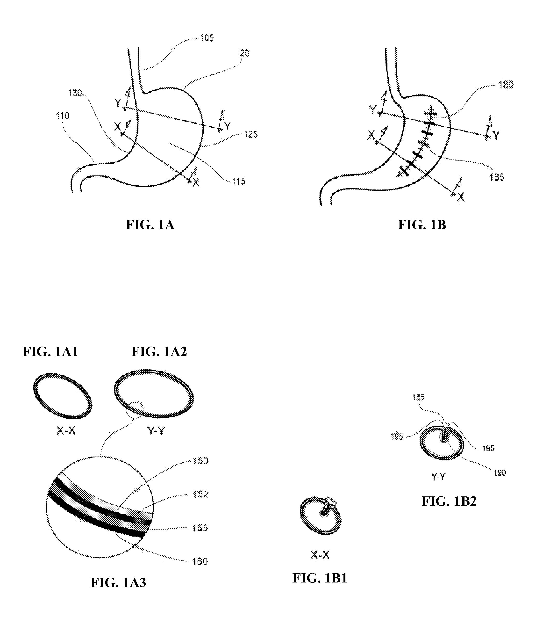 Devices and systems for manipulating tissue