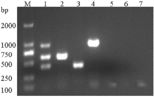 Triple PCR (Polymerase Chain Reaction) detection method of muscovy duck parvovirus, goose parvovirus and avian adenovirus type 4