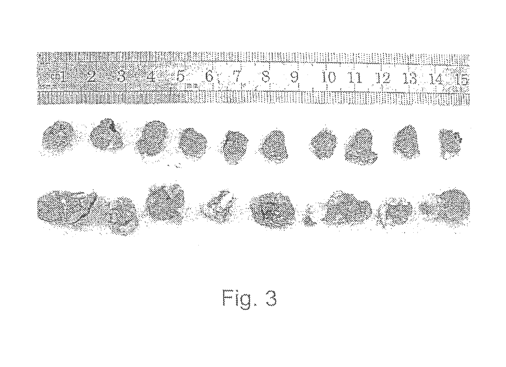 Methods for decreasing leptin levels or activity for treating inflammation