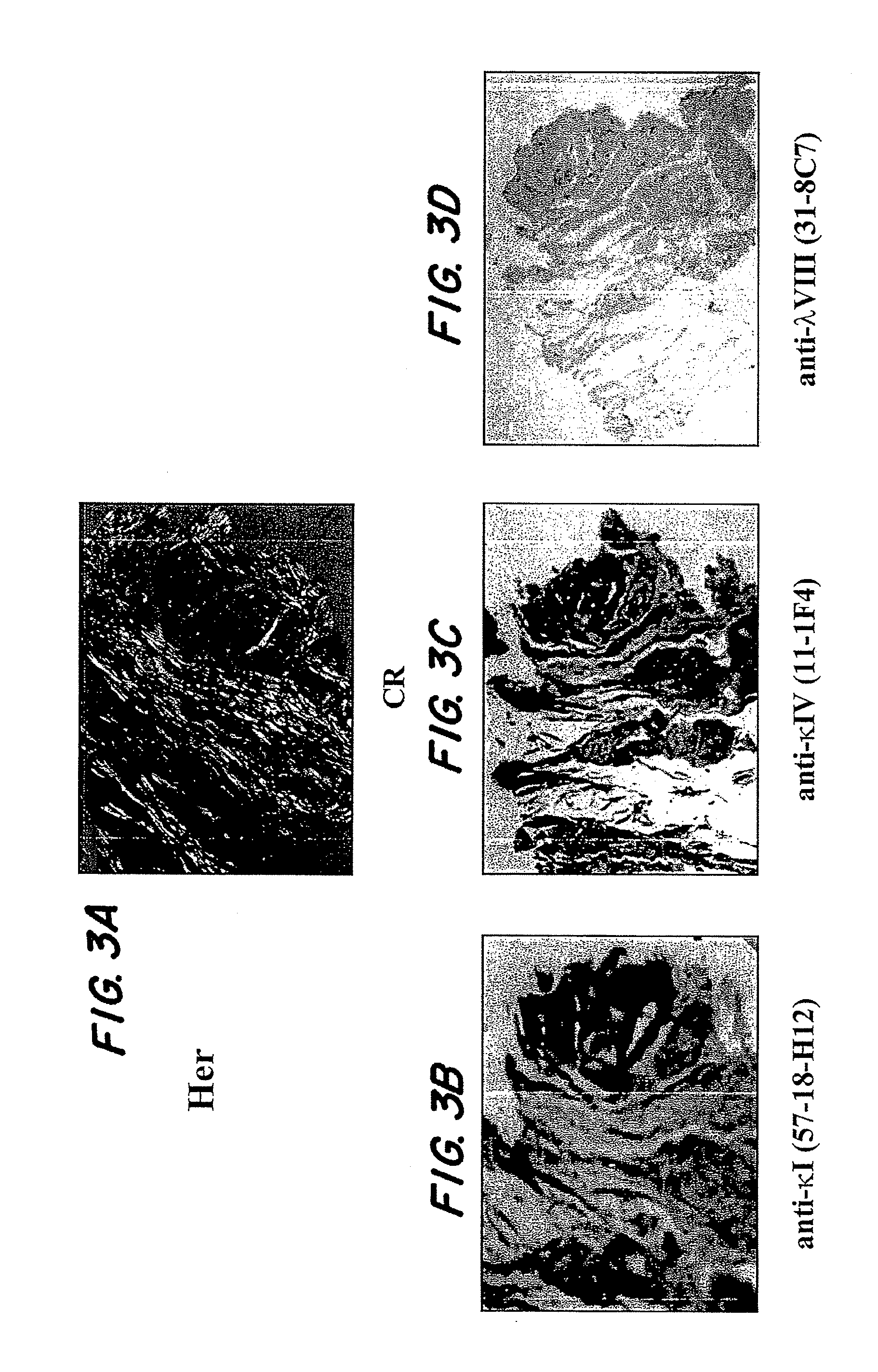 Methods for amyloid removal using anti-amyloid antibodies