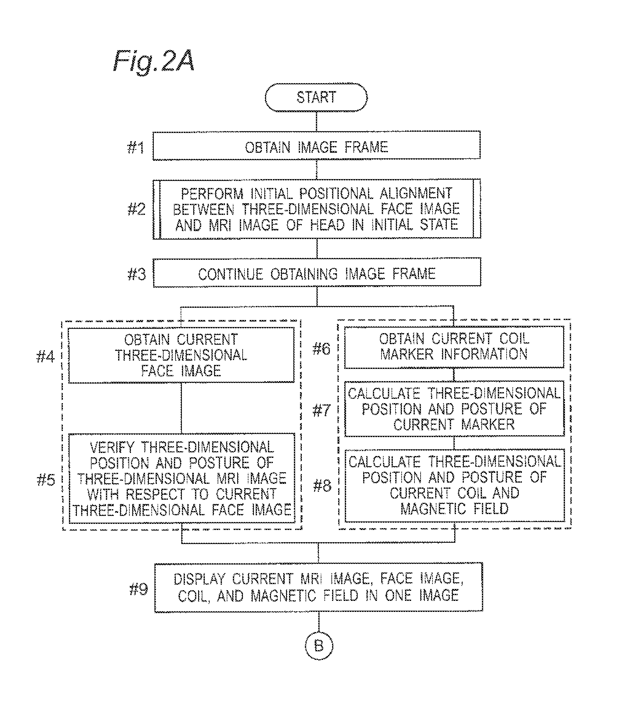 Image data processing device and transcranial magnetic stimulation apparatus