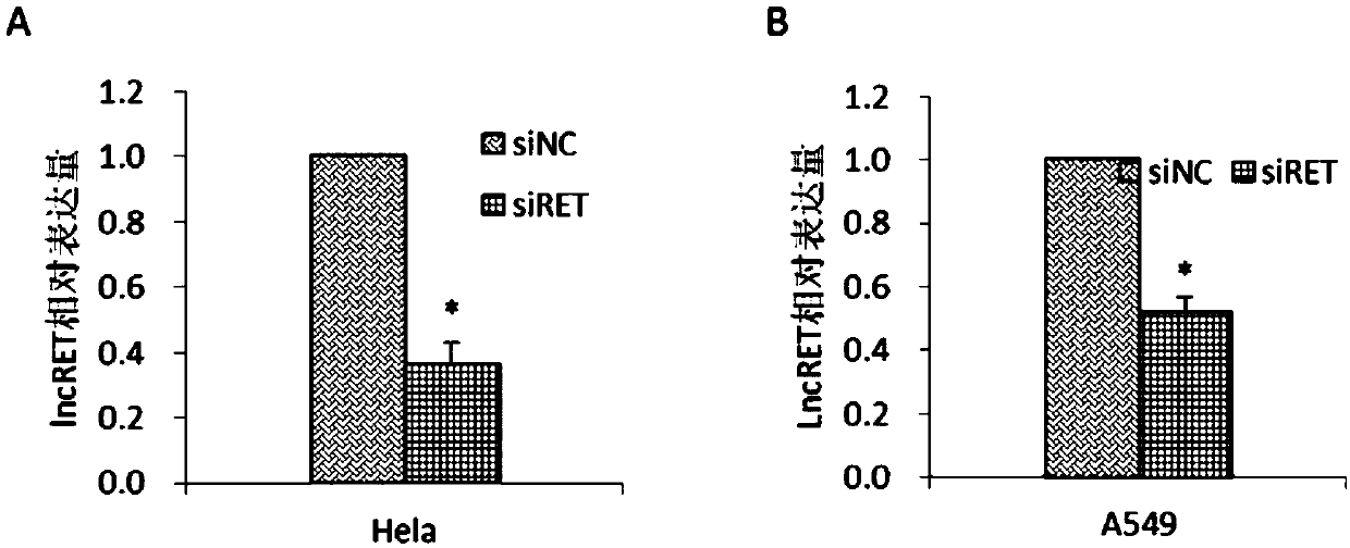 Application of LncRNA RET in regulating and controlling radiosensitivity of tumor cells