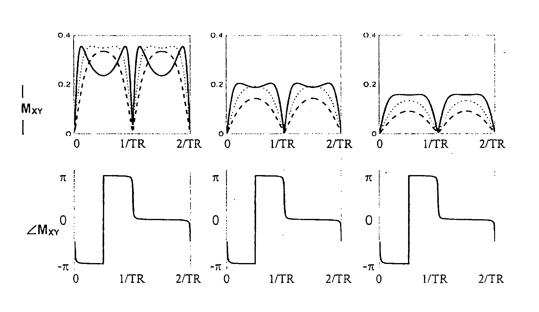 Artifact reduction in SSFP MRI using weighted sum of combined signals