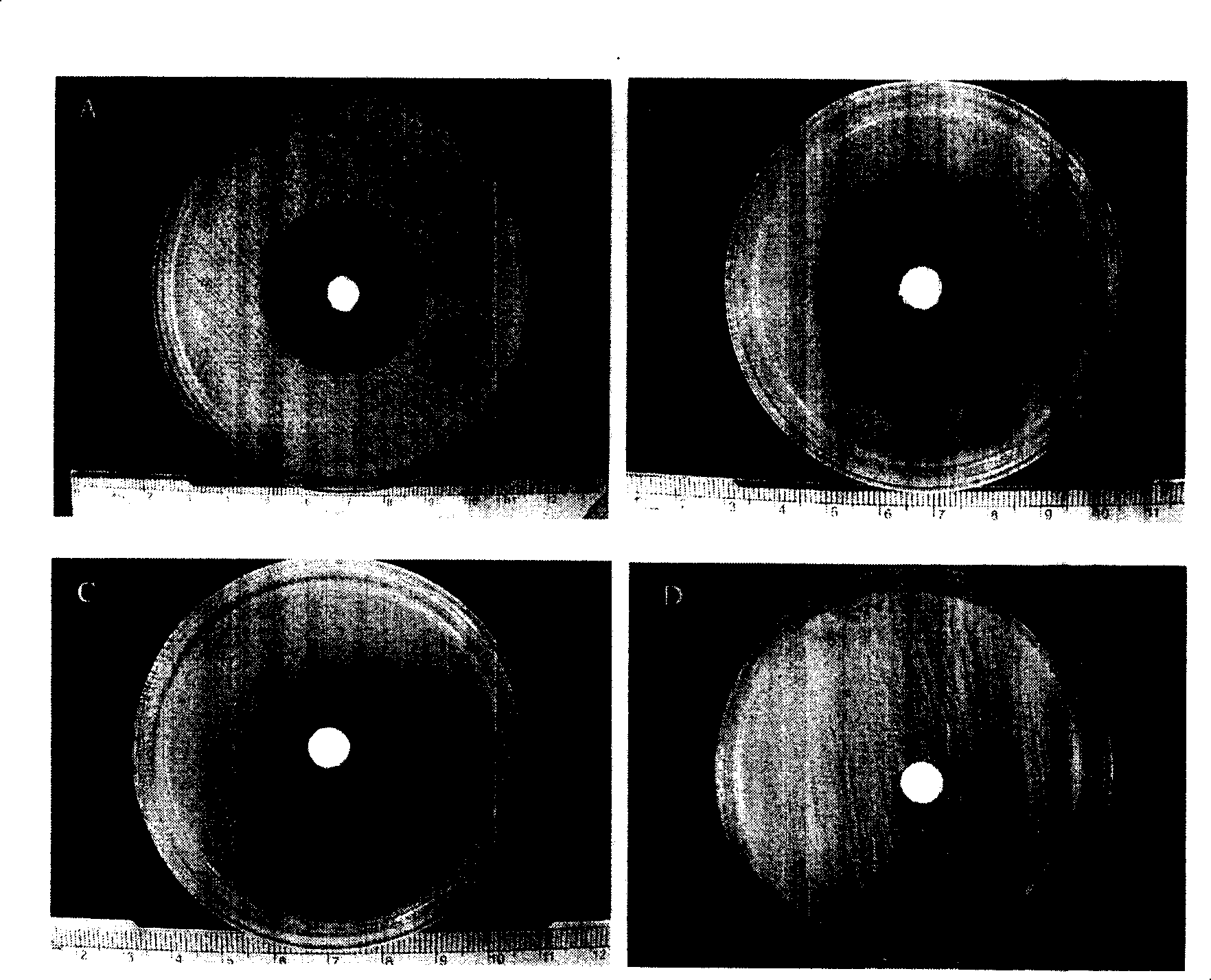 Medicine for treating osteomyelitis and preparation thereof