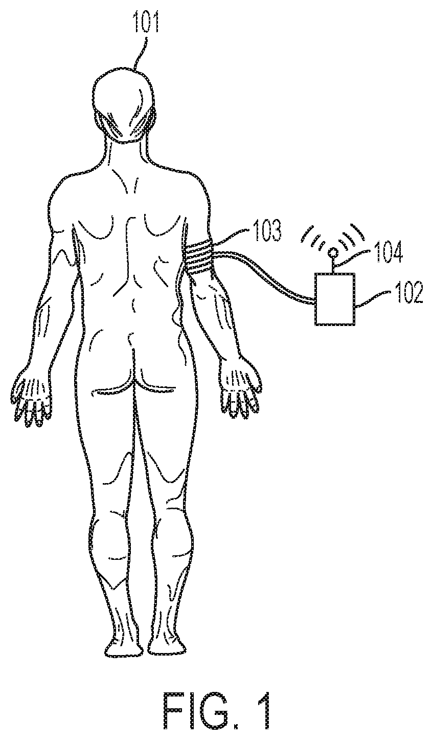 Forecasting a patient vital measurement for healthcare analytics