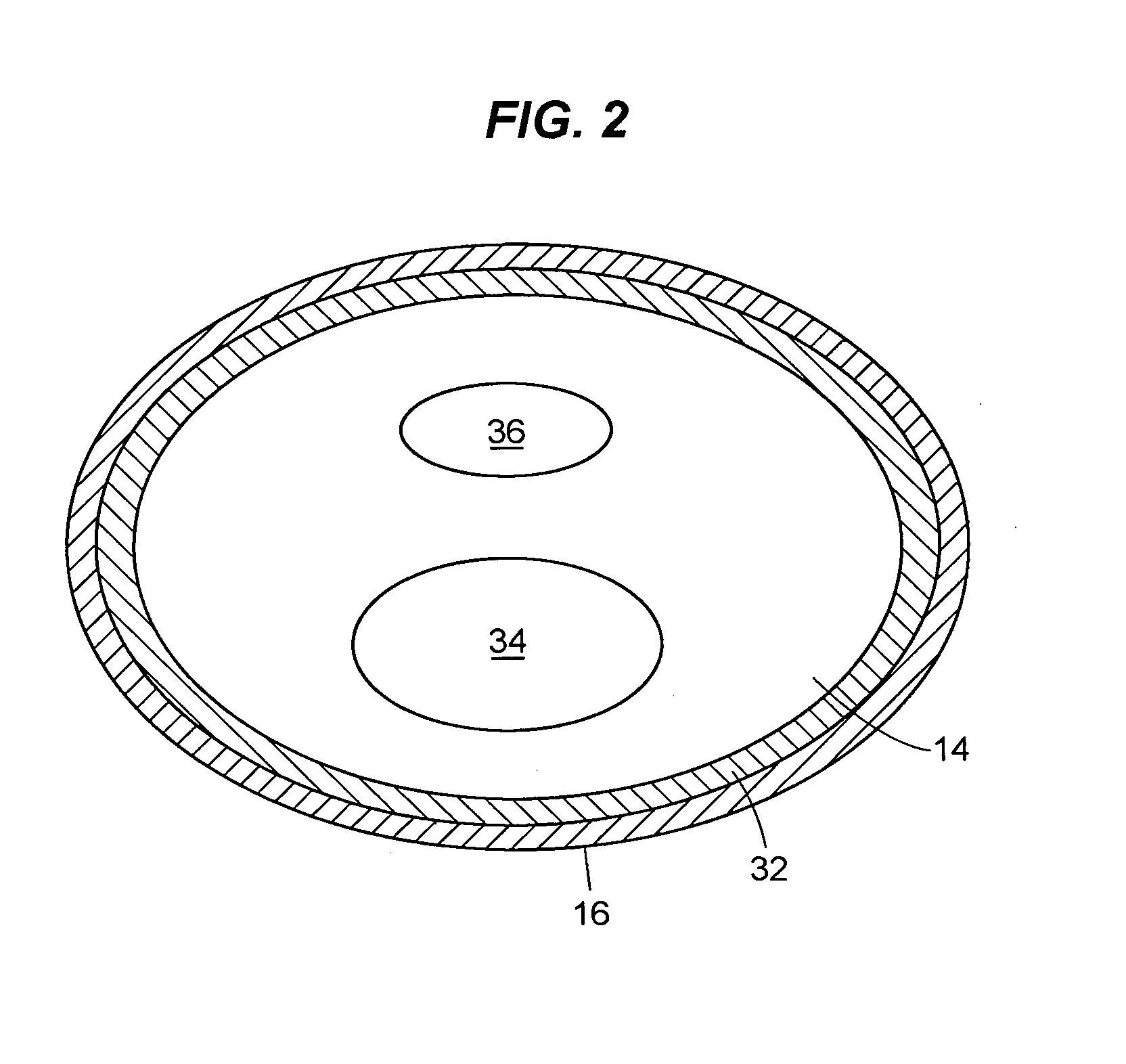 Non-invasive tracking device and method