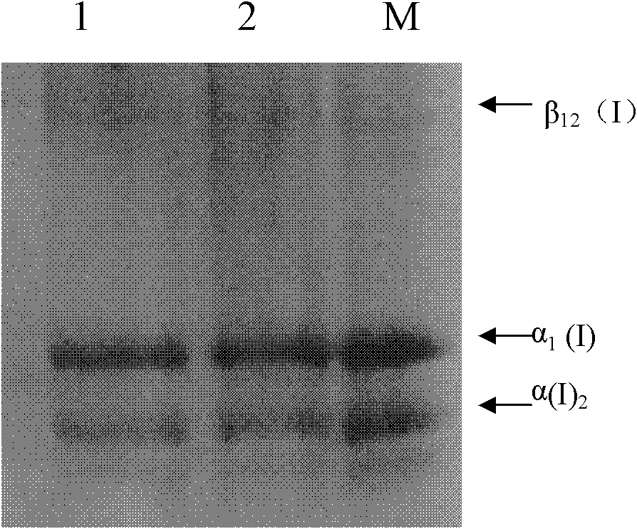 Collagen gel and preparation method thereof