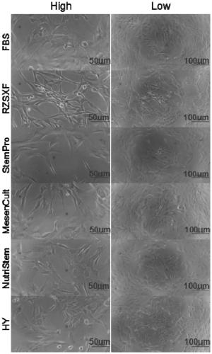 Human stem cell RZSXF-SC and establishing method and application thereof