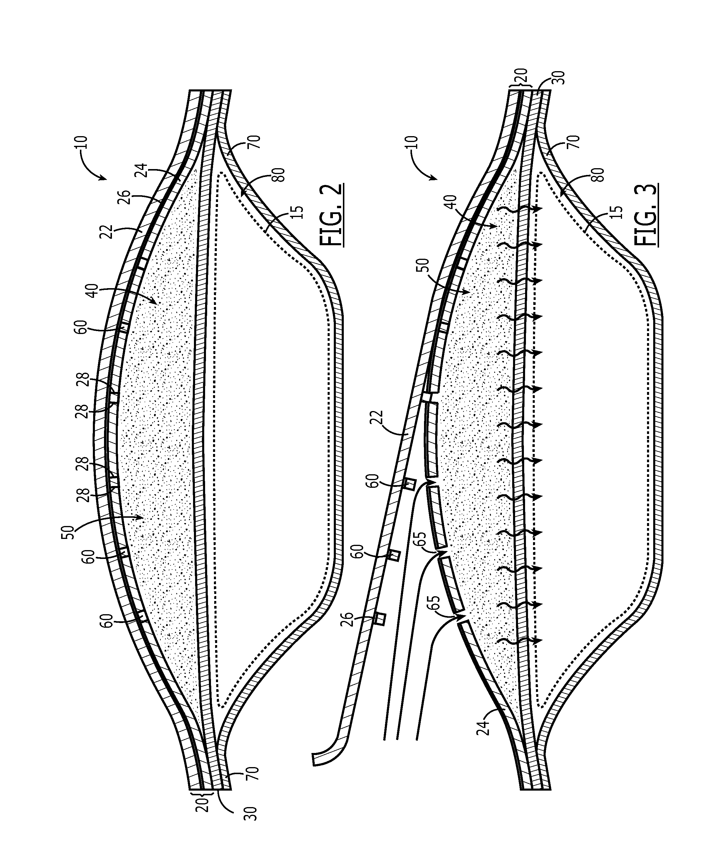 Container having self-contained heater material