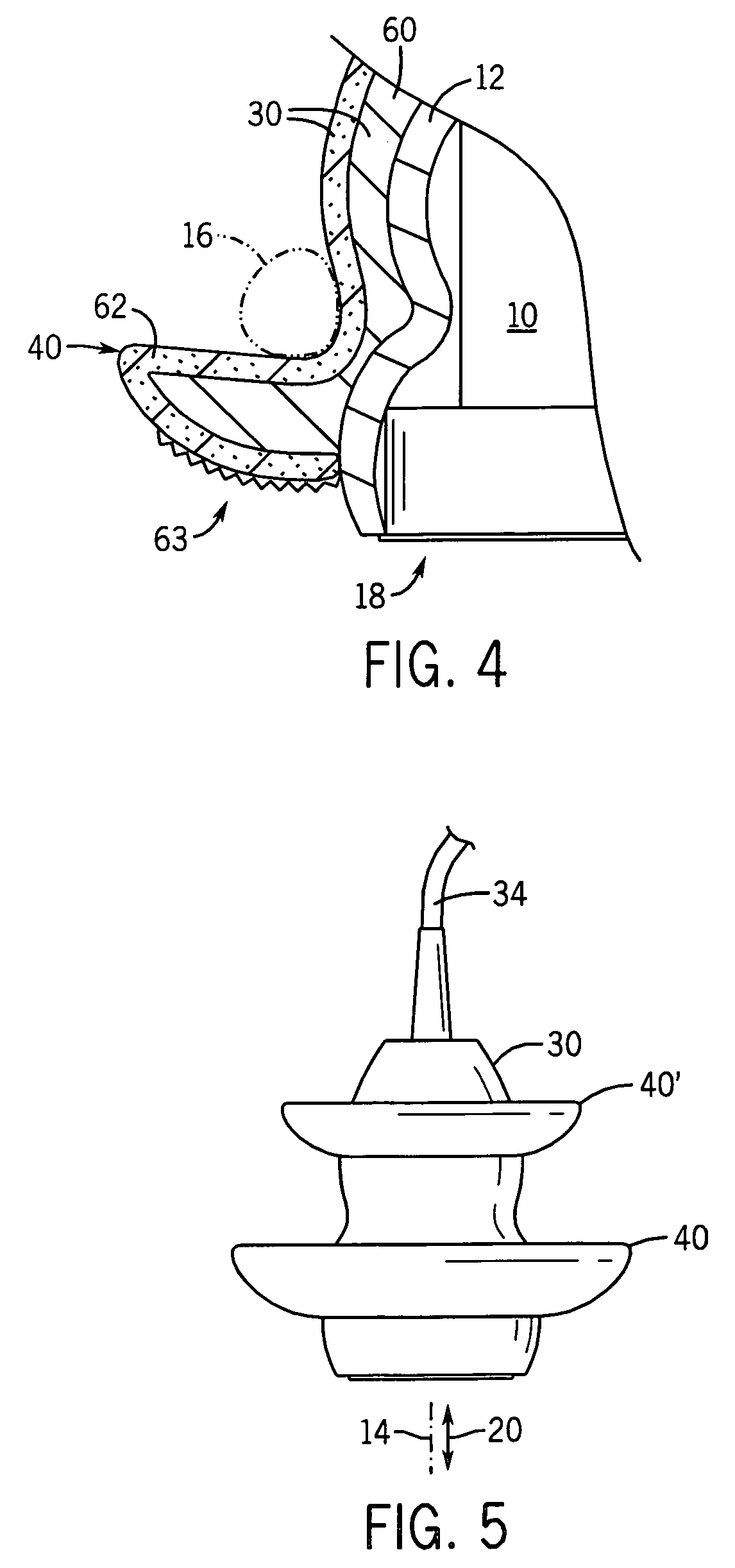 Ultrasonic probe with finger shelf