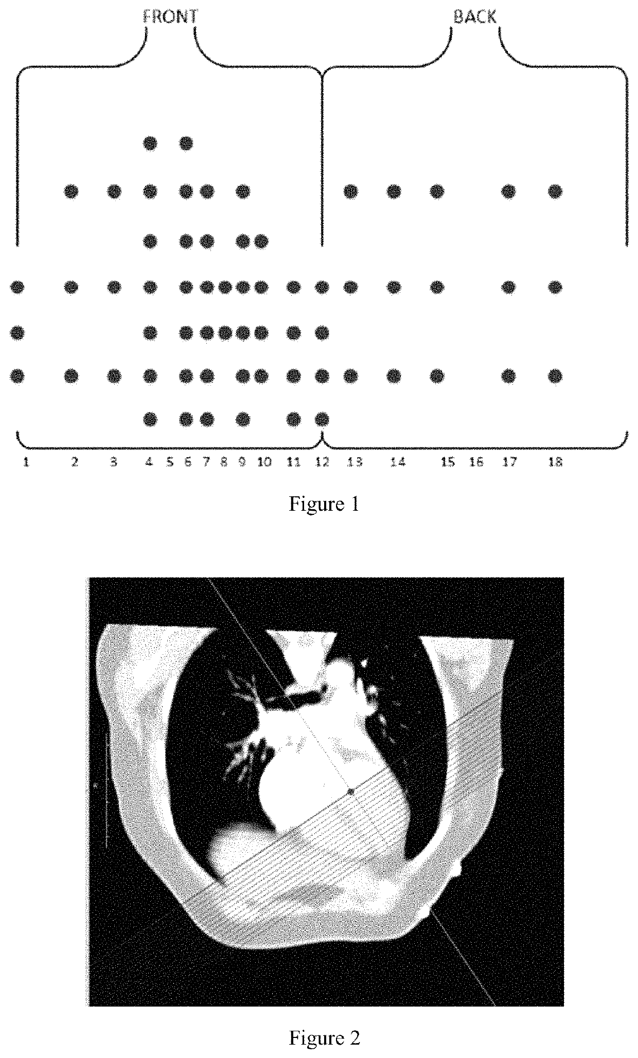 Method for noninvasive imaging of cardiac electrophysiological based on low rank and sparse constraints